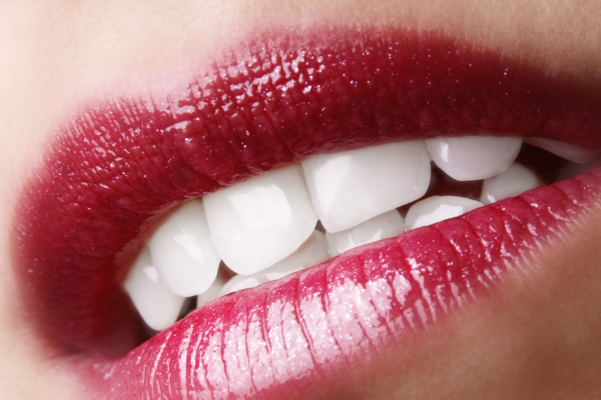 Kings Langley Beauty Therapy - Teeth Whitening